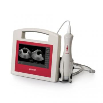 挪威威康膀胱超声扫描仪VitaScan