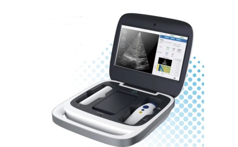 意领定量剪切波超声肝脏测量仪Liverscan Mobile
