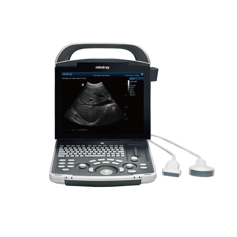 迈瑞Mindray 全数字便携式超声诊断系统 DP-30（主机+浅表75L38EA）