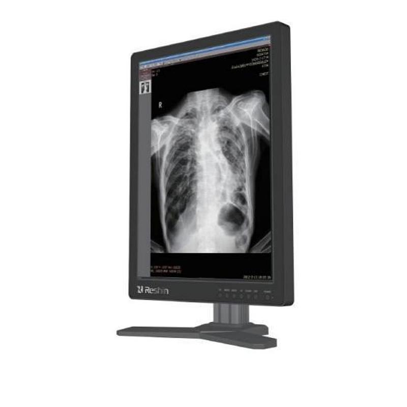 睿显 医用显示器 MD22CA（彩色）