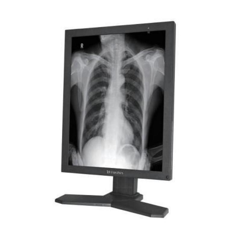 睿显 医用显示器 MD26GA