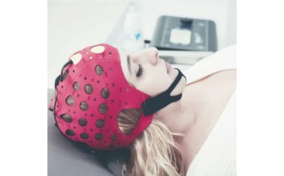 Ionclinics TDCS 电经颅刺激器 EPTE®