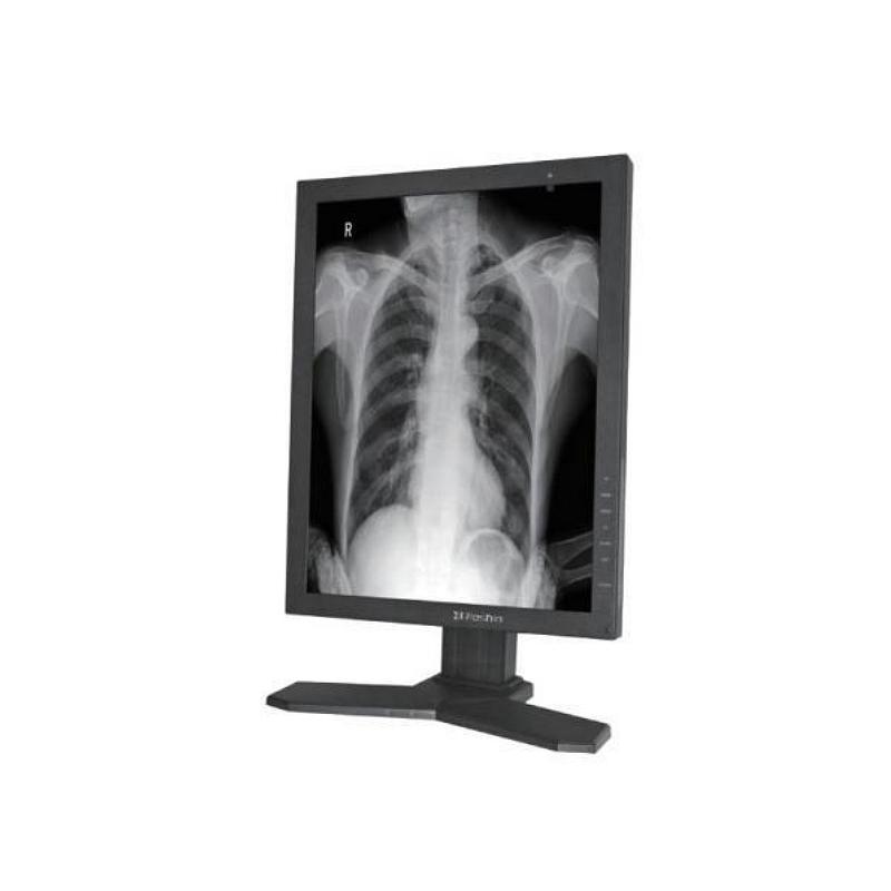 睿显 医用显示器 MD33G（灰阶）
